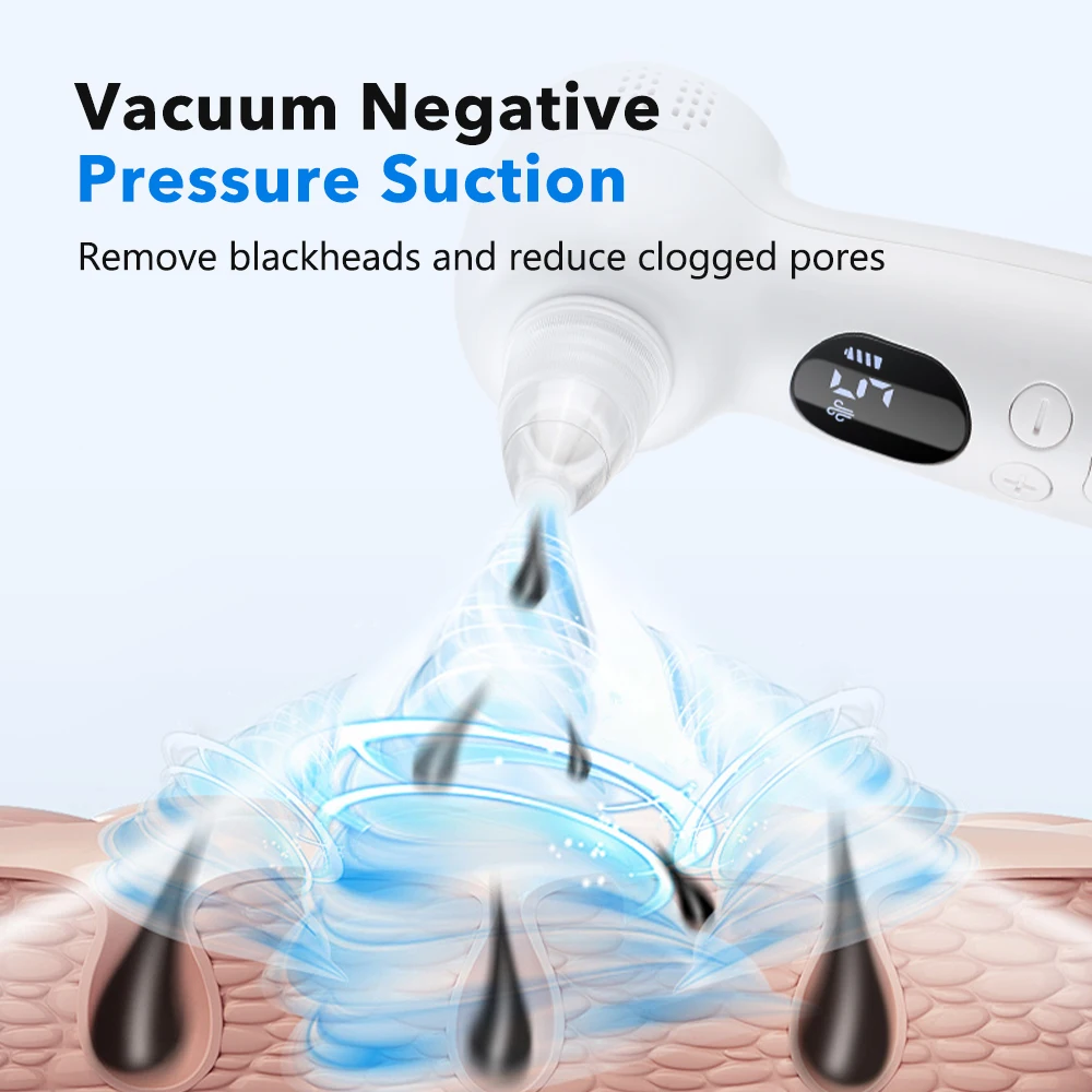 黒ずみ除去毛穴掃除機 温湿布機能付き 5段階吸引レベル 3段 - Pore Vacuum のレビューと価格